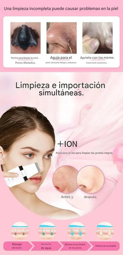 Espátula Facial Ultrasónica Limpieza Profunda Puntos Negros Blanco