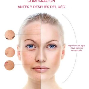 Everest Vaporizador Facial: imagen 8