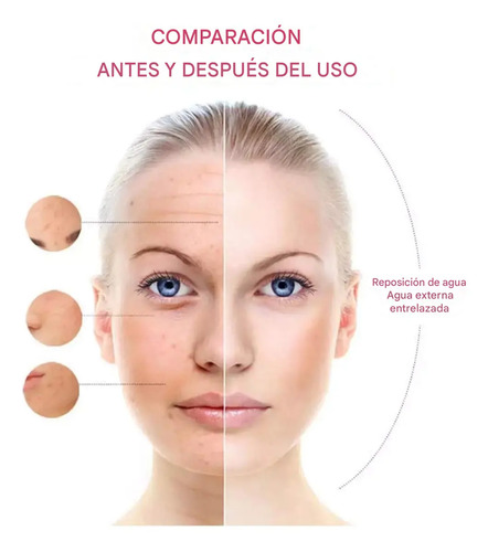 Everest Vaporizador Facial