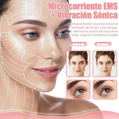 Masajeador Facial Microcorriente Ems + Vibración Sónica Everest, Rodillos Dobles Antiarrugas, Reafirmante Y Lifting Para Contorno Facial, Adiós Ojeras Y Líneas De Expresión, Portátil (C) Rosado